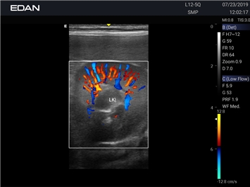 EDAN Acclarix AX2 VET