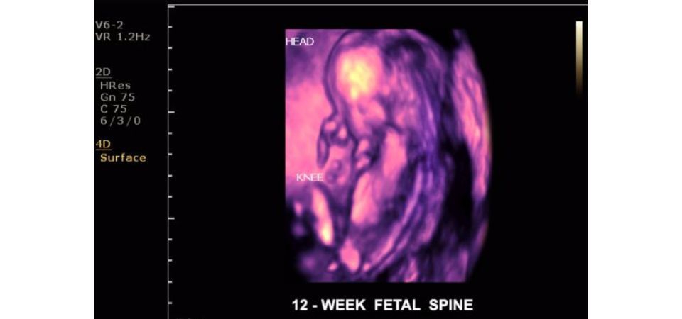 Philips ClearVue 650