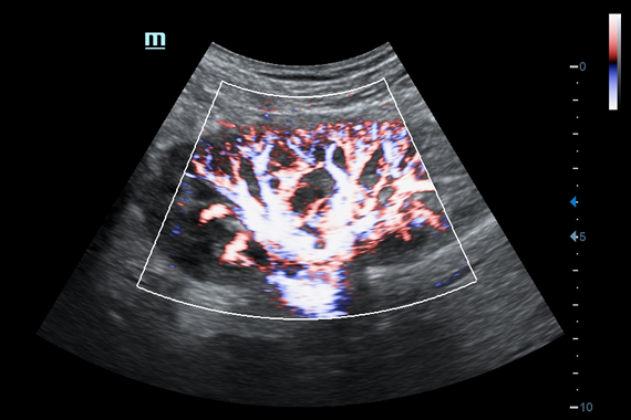 Mindray DC-60 Exp X-Insight