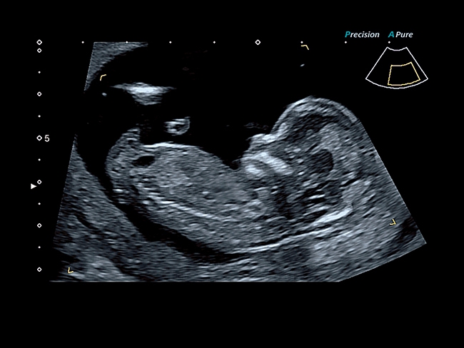 Canon Toshiba Xario 200G