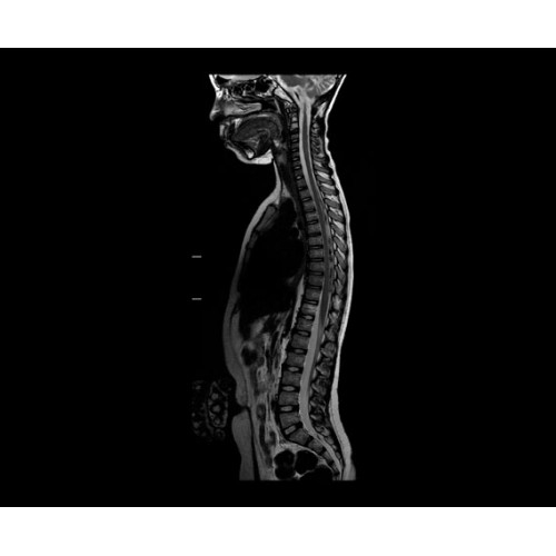 МРТ аппарат GE SIGNA PET/MR 3.0T