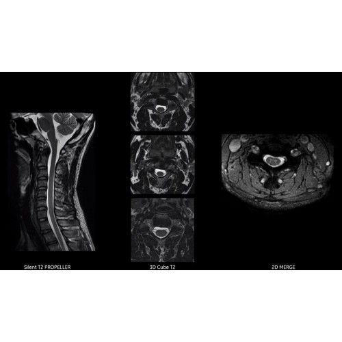 МРТ аппарат GE SIGNA Pioneer 3.0T