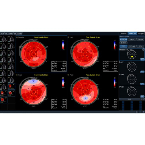 ViewPoint 6 и комплект EchoPAC Suite для кардиологических исследований